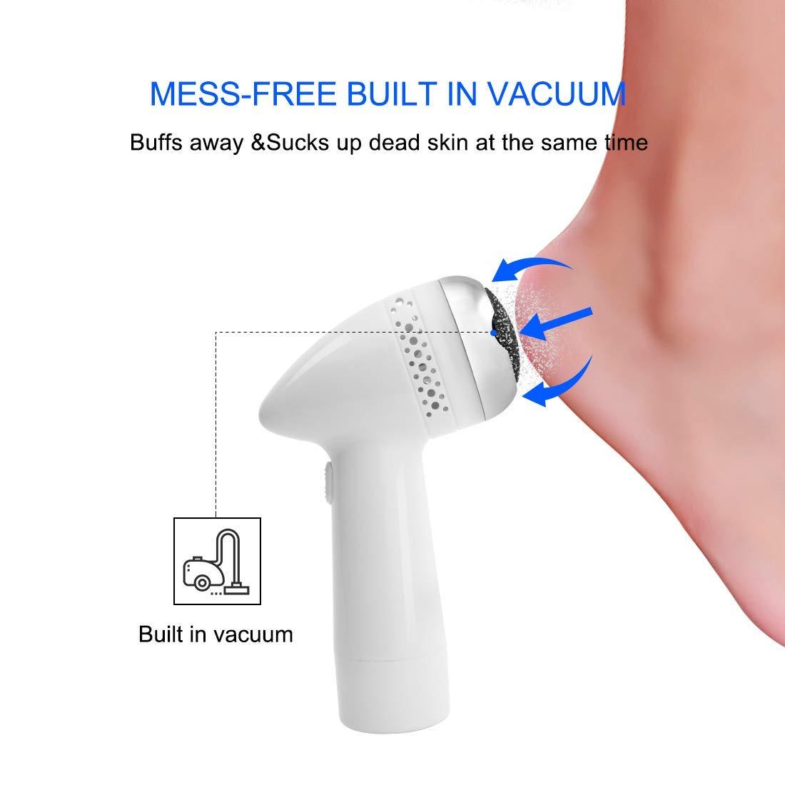 Electric Foot Polisher with Vacuum — Callus Remover, Dead Skin Exfoliator for Smooth Heels