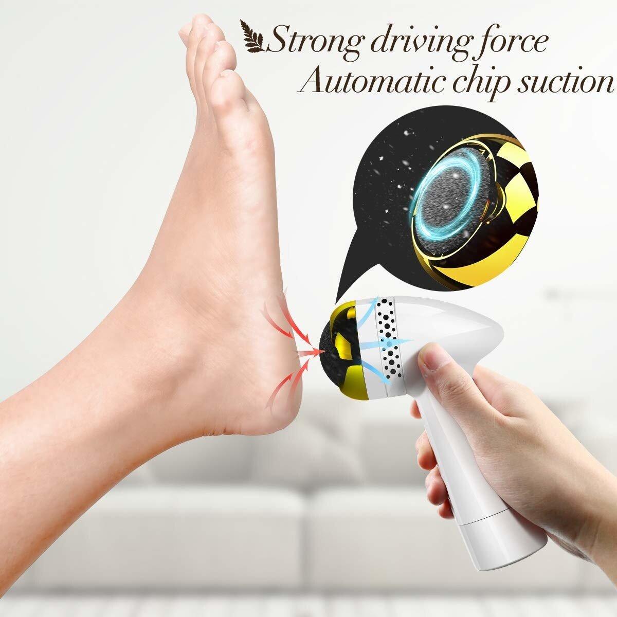 Electric Foot Polisher with Vacuum — Callus Remover, Dead Skin Exfoliator for Smooth Heels